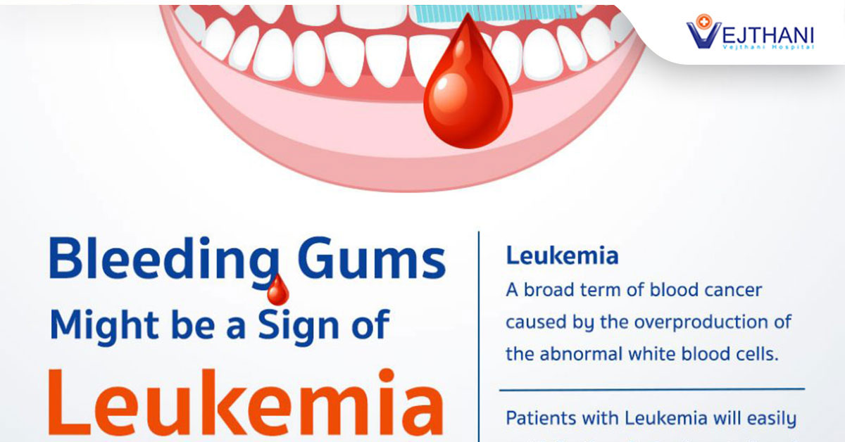 Bleeding Gums Might be a Sign of Leukemia - Life Cancer Center