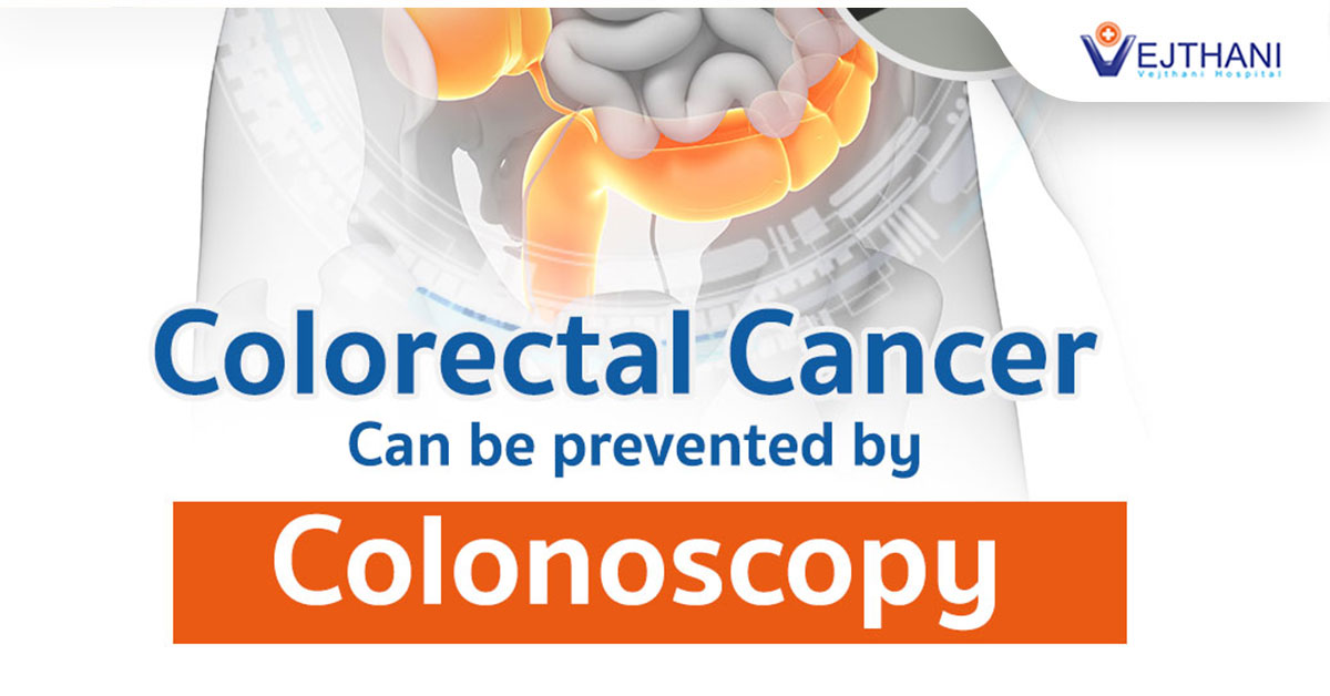 Colorectal Cancer Can Be Prevented By Colonoscopy Life Cancer Center